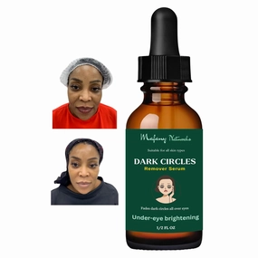 Dark circles, Dark Under Eye Serum, Dark Circles Eraser serum 0.5 FL OZ
