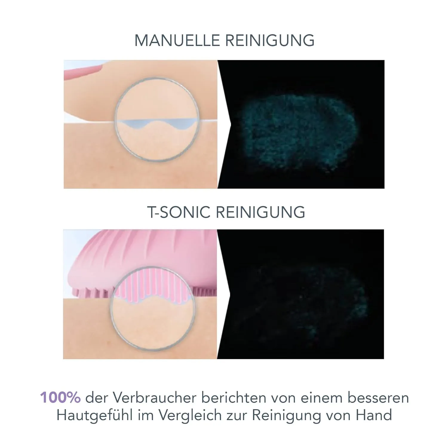 FOREO LUNA 3 Facial Cleansing Brush | Sensitive Skin | Anti Aging Face Massager | Enhances Absorption of Facial Products | For Clean & Healthy Face Care | Simple & Easy | Waterproof