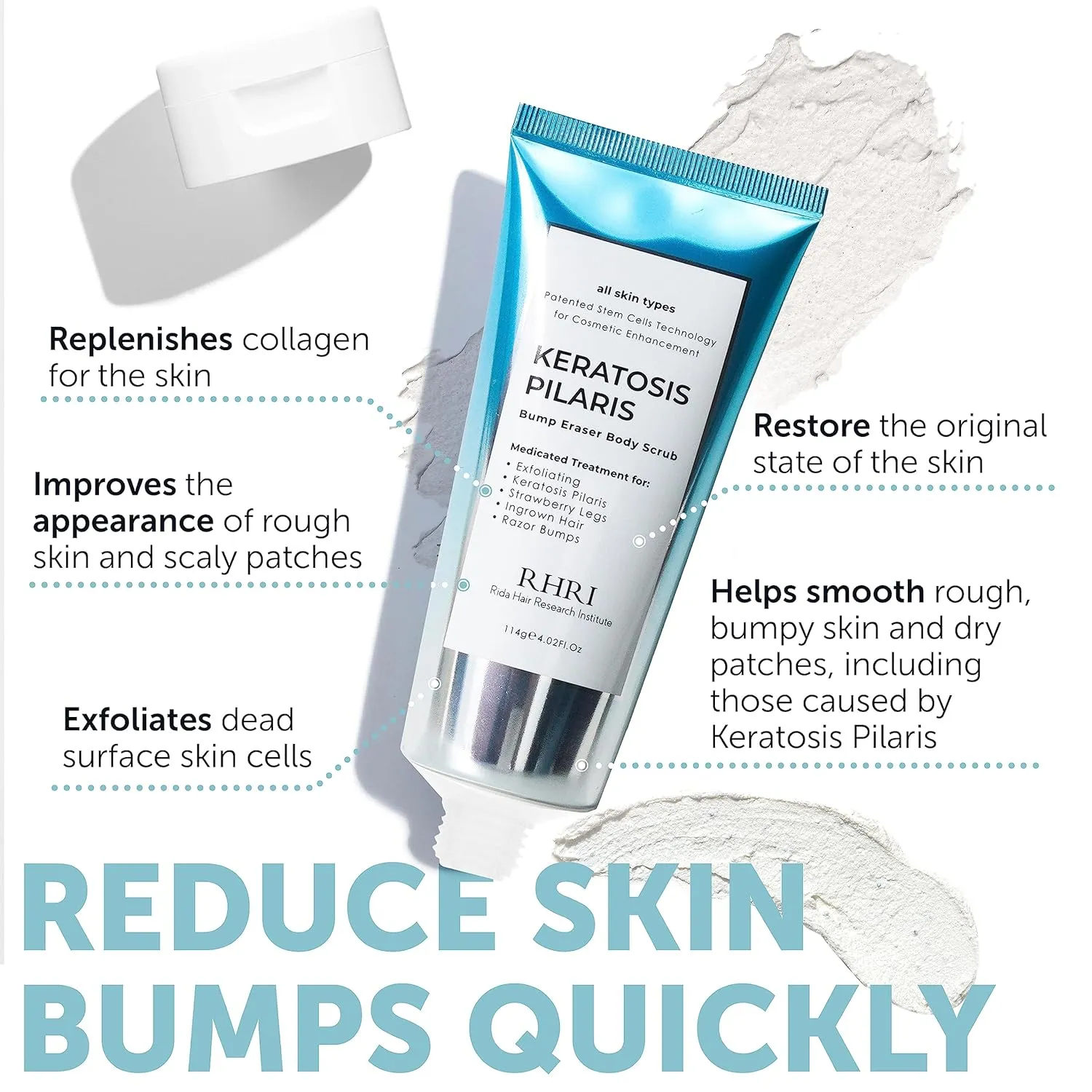 KP Bump Eraser Body Scrub | Keratosis Pilaris Treatment | Bump Eraser Body Scrub | Exfoliating Body Scrun | Ingrown Hair Treatment | Clears Strawberry Legs | Soothes Redness, Dryness & Flaky Skin