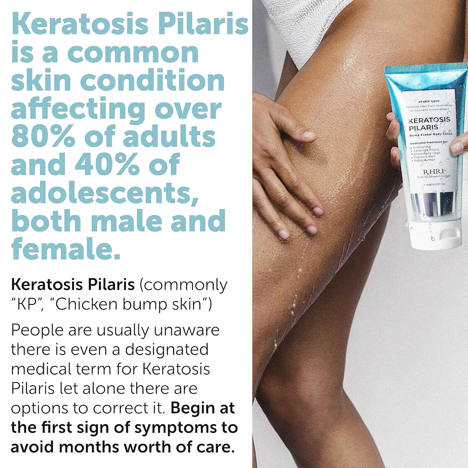 KP Bump Eraser Body Scrub | Keratosis Pilaris Treatment | Bump Eraser Body Scrub | Exfoliating Body Scrun | Ingrown Hair Treatment | Clears Strawberry Legs | Soothes Redness, Dryness & Flaky Skin