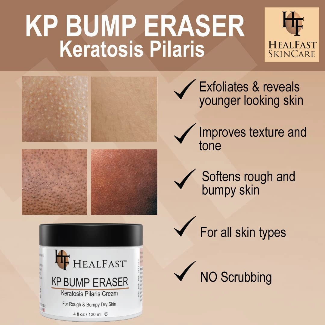 KP Bump Eraser Cream 4 Oz – Soften, Nourish Rough and Bumpy Skin with 2% BHA – Keratosis Pilaris - For All Types – No Scrubbing Required – Fragrance and Paraben Free