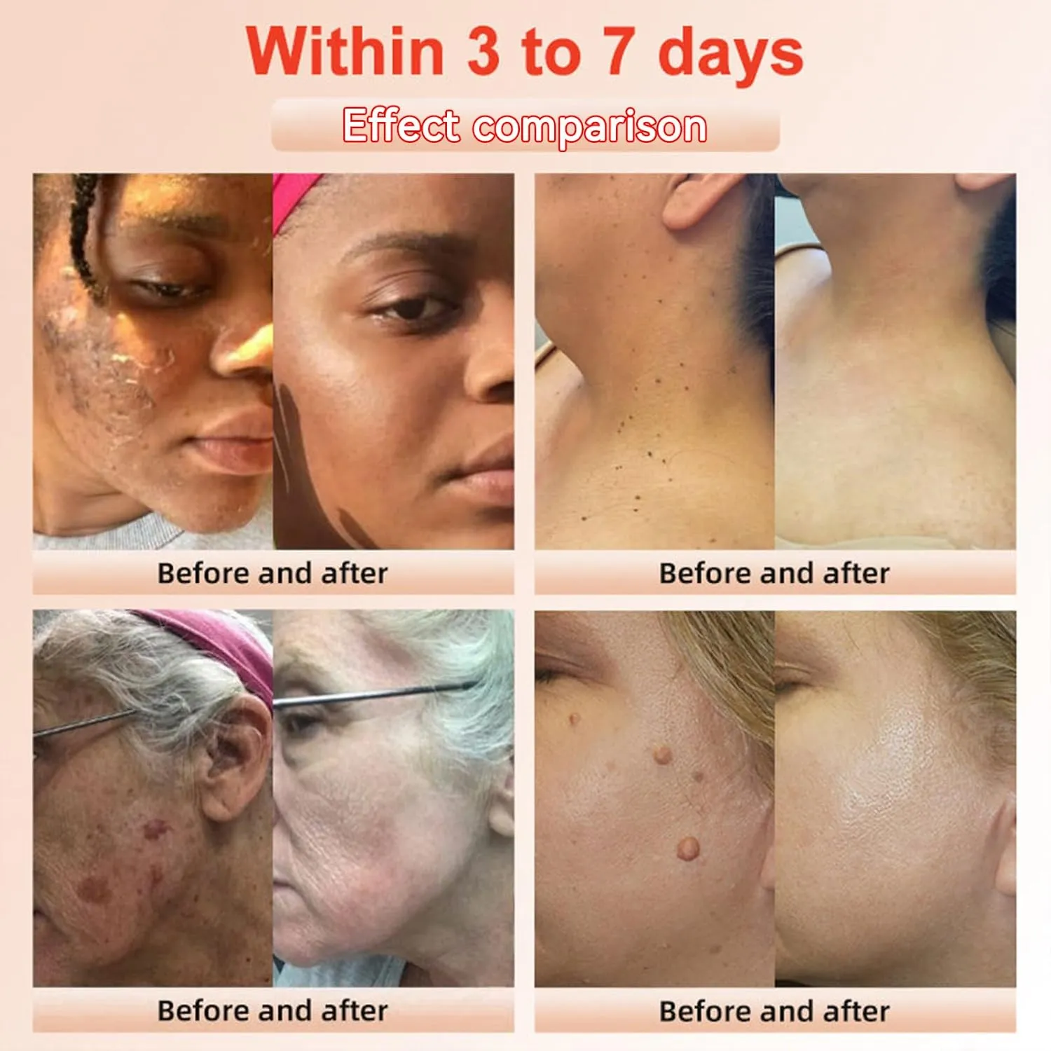Purifying Exfoliating Gel, Facial Exfoliator Cleanser, Deep Cleansing Face and Body Exfoliating Scrub Gel, Moisturizing Cleanses Skin Give Cleans Dirt & Oils (4 Pack)