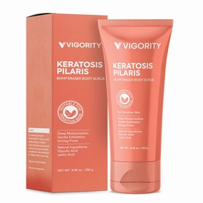 Vigority KP Bump Eraser Body Scrub: Keratosis Pilaris Treatment for Strawberry Legs - Exfoliates & Deeply Hydrates for Smoother Healthy-Looking Skin
